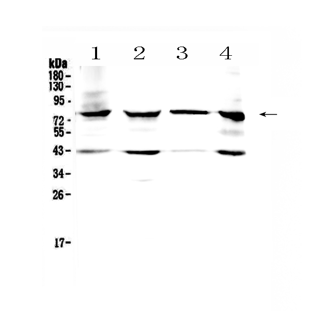 HSD17B4 Antibody - Western blot analysis of HSD17B4 using anti-HSD17B4 antibody. Electrophoresis was performed on a 5-20% SDS-PAGE gel at 70V (Stacking gel) / 90V (Resolving gel) for 2-3 hours. The sample well of each lane was loaded with 50ug of sample under reducing conditions. Lane 1: mouse heart tissue lysates, Lane 2: rat heart tissue lysates, Lane 3: human placenta tissue lysates, Lane 4: MCF-7 whole cell lysates. After Electrophoresis, proteins were transferred to a Nitrocellulose membrane at 150mA for 50-90 minutes. Blocked the membrane with 5% Non-fat Milk/ TBS for 1.5 hour at RT. The membrane was incubated with rabbit anti-HSD17B4 antigen affinity purified polyclonal antibody at 0.5 µg/mL overnight at 4°C, then washed with TBS-0.1% Tween 3 times with 5 minutes each and probed with a goat anti-rabbit IgG-HRP secondary antibody at a dilution of 1:10000 for 1.5 hour at RT. The signal is developed using an Enhanced Chemiluminescent detection (ECL) kit with Tanon 5200 system. A specific band was detected for HSD17B4 at approximately 80KD. The expected band size for HSD17B4 is at 80KD.