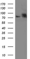 HSD17B4 Antibody - HEK293T cells were transfected with the pCMV6-ENTRY control (Left lane) or pCMV6-ENTRY HSD17B4 (Right lane) cDNA for 48 hrs and lysed. Equivalent amounts of cell lysates (5 ug per lane) were separated by SDS-PAGE and immunoblotted with anti-HSD17B4.