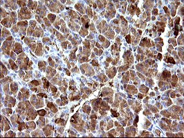HSD17B4 Antibody - IHC of paraffin-embedded Human pancreas tissue using anti-HSD17B4 mouse monoclonal antibody. (Heat-induced epitope retrieval by 10mM citric buffer, pH6.0, 120°C for 3min).