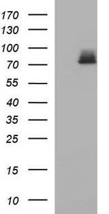 HSD17B4 Antibody - HEK293T cells were transfected with the pCMV6-ENTRY control (Left lane) or pCMV6-ENTRY HSD17B4 (Right lane) cDNA for 48 hrs and lysed. Equivalent amounts of cell lysates (5 ug per lane) were separated by SDS-PAGE and immunoblotted with anti-HSD17B4.