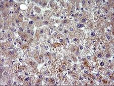 HSD17B4 Antibody - IHC of paraffin-embedded Human liver tissue using anti-HSD17B4 mouse monoclonal antibody. (Heat-induced epitope retrieval by 10mM citric buffer, pH6.0, 120°C for 3min).