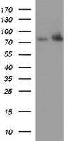 HSD17B4 Antibody - HEK293T cells were transfected with the pCMV6-ENTRY control (Left lane) or pCMV6-ENTRY HSD17B4 (Right lane) cDNA for 48 hrs and lysed. Equivalent amounts of cell lysates (5 ug per lane) were separated by SDS-PAGE and immunoblotted with anti-HSD17B4.