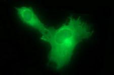 HSD17B4 Antibody - Anti-HSD17B4 mouse monoclonal antibody immunofluorescent staining of COS7 cells transiently transfected by pCMV6-ENTRY HSD17B4.