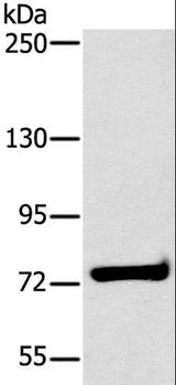 HSD17B4 Antibody - Western blot analysis of K562 cell, using HSD17B4 Polyclonal Antibody at dilution of 1:400.