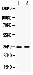 HSD17B6 Antibody - anti-HSD17B6 antibody, Western blotting All lanes: Anti HSD17B6 at 0.5ug/ml Lane 1: Human Placenta Tissue Lysate at 50ugLane 2: MCF-7 Whole Cell Lysate at 40ugPredicted bind size: 35KD Observed bind size: 35KD