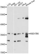 HSD17B6 Antibody - Western blot analysis of extracts of various cell lines, using HSD17B6 antibody at 1:1000 dilution. The secondary antibody used was an HRP Goat Anti-Rabbit IgG (H+L) at 1:10000 dilution. Lysates were loaded 25ug per lane and 3% nonfat dry milk in TBST was used for blocking. An ECL Kit was used for detection and the exposure time was 10s.
