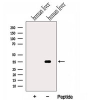 HSD17B6 Antibody - Western blot analysis of extracts of human liver tissue using HSD17B6 antibody. The lane on the left was treated with blocking peptide.