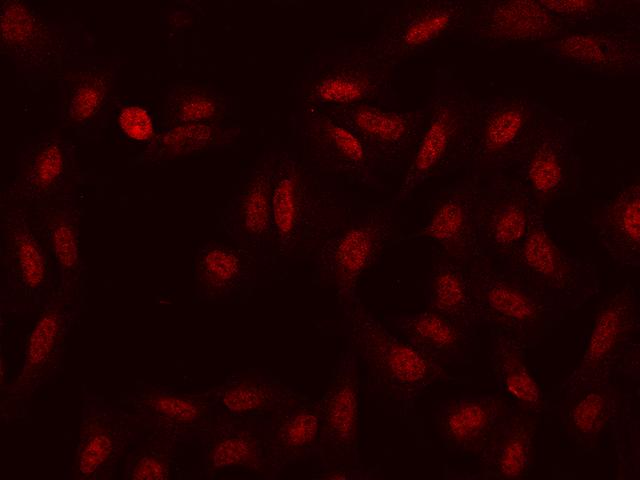 HSD17B6 Antibody - Immunofluorescence staining of HSD17B6 in U2OS cells. Cells were fixed with 4% PFA, permeabilzed with 0.1% Triton X-100 in PBS, blocked with 10% serum, and incubated with rabbit anti-Human HSD17B6 polyclonal antibody (dilution ratio 1:100) at 4°C overnight. Then cells were stained with the Alexa Fluor 594-conjugated Goat Anti-rabbit IgG secondary antibody (red). Positive staining was localized to Nucleus.