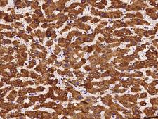 HSD17B6 Antibody - Immunochemical staining of human HSD17B6 in human liver with rabbit polyclonal antibody at 1:200 dilution, formalin-fixed paraffin embedded sections.