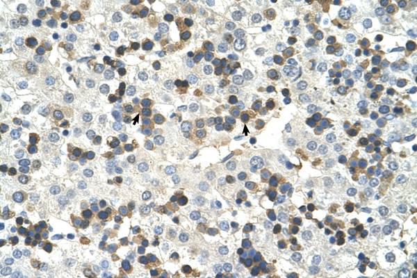 HSD17B6 Antibody - HSD17B6 antibody ARP41529_T100-NP_003716-HSD17B6(hydroxysteroid (17-beta) dehydrogenase 6 homolog (mouse)) Antibody IHC of formalin-fixed, paraffin-embedded human Liver. Positive label: Hematopoietic cells indicated with arrows. Antibody concentration 4-8 ug/ml. Magnification 400X.  This image was taken for the unconjugated form of this product. Other forms have not been tested.