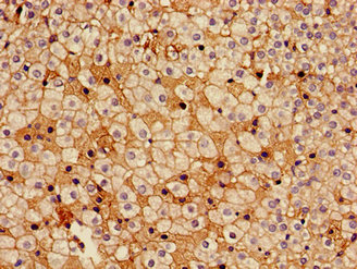 HSD17B7 / PRAP Antibody - Immunohistochemistry image of paraffin-embedded human adrenal gland tissue at a dilution of 1:100