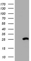 HSD17B8 / RING2 Antibody - HEK293T cells were transfected with the pCMV6-ENTRY control (Left lane) or pCMV6-ENTRY HSD17B8 (Right lane) cDNA for 48 hrs and lysed. Equivalent amounts of cell lysates (5 ug per lane) were separated by SDS-PAGE and immunoblotted with anti-HSD17B8.