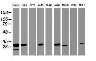 HSD17B8 / RING2 Antibody - Western blot of extracts (35 ug) from 9 different cell lines by using anti-HSD17B8 monoclonal antibody (HepG2: human; HeLa: human; SVT2: mouse; A549: human; COS7: monkey; Jurkat: human; MDCK: canine; PC12: rat; MCF7: human).