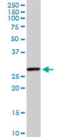 HSD17B8 / RING2 Antibody - HSD17B8 monoclonal antibody (M01), clone 4F1. Western Blot analysis of HSD17B8 expression in human pancreas.