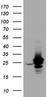 HSD17B8 / RING2 Antibody - HEK293T cells were transfected with the pCMV6-ENTRY control (Left lane) or pCMV6-ENTRY HSD17B8 (Right lane) cDNA for 48 hrs and lysed. Equivalent amounts of cell lysates (5 ug per lane) were separated by SDS-PAGE and immunoblotted with anti-HSD17B8.
