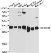 HSD17B8 / RING2 Antibody - Western blot analysis of extracts of various cell lines, using HSD17B8 Antibody at 1:3000 dilution. The secondary antibody used was an HRP Goat Anti-Rabbit IgG (H+L) at 1:10000 dilution. Lysates were loaded 25ug per lane and 3% nonfat dry milk in TBST was used for blocking. An ECL Kit was used for detection and the exposure time was 90s.