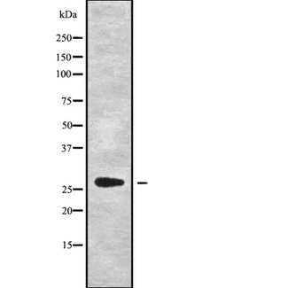 HSD17B8 / RING2 Antibody - Western blot analysis of HSD17B8 using A549 whole cells lysates