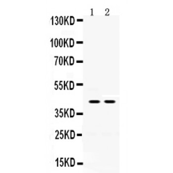 HSD2 / HSD11B2 Antibody - HSD11B2 antibody Western blot. All lanes: Anti HSD11B2 at 0.5 ug/ml. Lane 1: Rat Kidney Tissue Lysate at 50 ug. Lane 2: Human Placenta Tissue Lysate at 50 ug. Predicted band size: 44 kD. Observed band size: 44 kD.