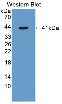 HSD2 / HSD11B2 Antibody - Western blot of HSD2 / HSD11B2 antibody.