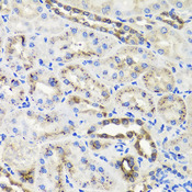 HSD2 / HSD11B2 Antibody - Immunohistochemistry of paraffin-embedded rat kidney tissue.