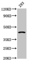 HSD2 / HSD11B2 Antibody - Positive Western Blot detected in 293 whole cell lysate. All lanes: HSD11B2 antibody at 2.4 µg/ml Secondary Goat polyclonal to rabbit IgG at 1/50000 dilution. Predicted band size: 45 KDa. Observed band size: 45 KDa