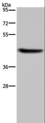 HSD3B1 Antibody - Western blot analysis of Human adrenal gland tissue, using HSD3B1 Polyclonal Antibody at dilution of 1:250.