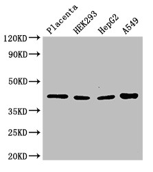 HSD3B1 Antibody - Positive WB detected in:Human placenta tissue,HEK293 whole cell lysate,HepG2 whole cell lysate,A549 whole cell lysate;All lanes:HSD3B1 antibody at 3?g/ml;Secondary;Goat polyclonal to rabbit IgG at 1/50000 dilution;Predicted band size: 43 KDa;Observed band size: 43 KDa;