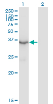 HSD3B2 Antibody - Western Blot analysis of HSD3B2 expression in transfected 293T cell line by HSD3B2 monoclonal antibody (M02), clone 1E8.Lane 1: HSD3B2 transfected lysate(42.1 KDa).Lane 2: Non-transfected lysate.