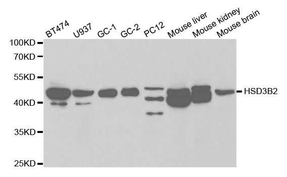 HSD3B2 Antibody - Western blot analysis of extracts of various cell lines.