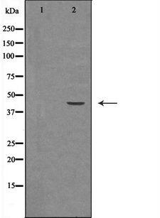 HSD3B2 Antibody - Western blot analysis of HeLa whole cells lysates using HSD3B2 antibody. The lane on the left is treated with the antigen-specific peptide.