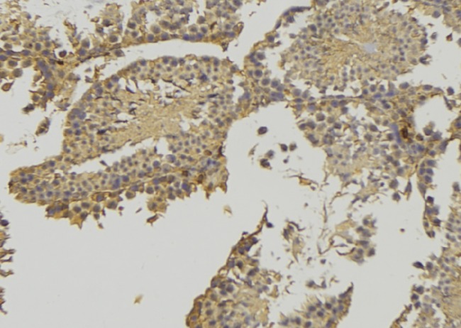 HSD3B2 Antibody - 1:100 staining rat testis tissue by IHC-P. The sample was formaldehyde fixed and a heat mediated antigen retrieval step in citrate buffer was performed. The sample was then blocked and incubated with the antibody for 1.5 hours at 22°C. An HRP conjugated goat anti-rabbit antibody was used as the secondary.