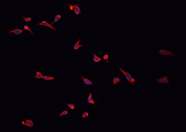 HSD3B2 Antibody - Staining HepG2 cells by IF/ICC. The samples were fixed with PFA and permeabilized in 0.1% Triton X-100, then blocked in 10% serum for 45 min at 25°C. The primary antibody was diluted at 1:200 and incubated with the sample for 1 hour at 37°C. An Alexa Fluor 594 conjugated goat anti-rabbit IgG (H+L) antibody, diluted at 1/600, was used as secondary antibody.