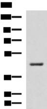 HSD3B2 Antibody - Western blot analysis of RAW264.7 cell lysate  using HSD3B2 Polyclonal Antibody at dilution of 1:600