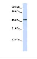 HSD3B2 Antibody - 293T cell lysate. Antibody concentration: 1.0 ug/ml. Gel concentration: 12%.  This image was taken for the unconjugated form of this product. Other forms have not been tested.