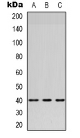 HSD3B7 Antibody - Western blot analysis of HSD3B7 expression in Lovo (A); MCF7 (B); HeLa (C) whole cell lysates.