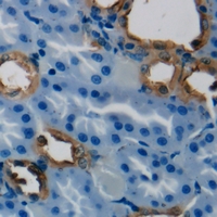 HSD3B7 Antibody - Immunohistochemical analysis of HSD3B7 staining in human kidney formalin fixed paraffin embedded tissue section. The section was pre-treated using heat mediated antigen retrieval with sodium citrate buffer (pH 6.0). The section was then incubated with the antibody at room temperature and detected using an HRP polymer system. DAB was used as the chromogen. The section was then counterstained with hematoxylin and mounted with DPX.