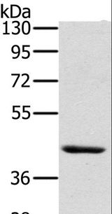 HSD3B7 Antibody - Western blot analysis of Skov3 cell, using HSD3B7 Polyclonal Antibody at dilution of 1:400.