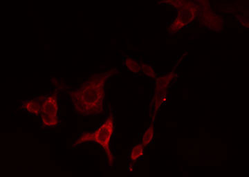HSD3B7 Antibody - Staining HeLa cells by IF/ICC. The samples were fixed with PFA and permeabilized in 0.1% Triton X-100, then blocked in 10% serum for 45 min at 25°C. The primary antibody was diluted at 1:200 and incubated with the sample for 1 hour at 37°C. An Alexa Fluor 594 conjugated goat anti-rabbit IgG (H+L) antibody, diluted at 1/600, was used as secondary antibody.