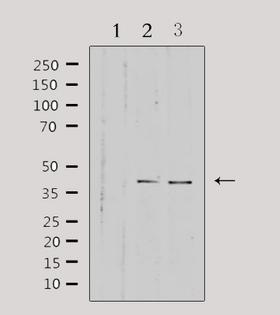 HSD3B7 Antibody - Western blot analysis of extracts of various samples using HSD3B7 antibody. Lane 1: 293 treated with blocking peptide; Lane 2: 293; Lane 3: HepG2;