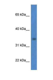HSDL1 Antibody - HSDL1 antibody Western blot of HCT15 Cell lysate. Antibody concentration 1 ug/ml.  This image was taken for the unconjugated form of this product. Other forms have not been tested.
