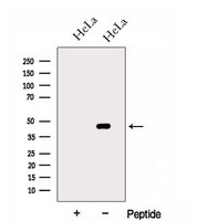 HSDL2 Antibody - Western blot analysis of extracts of HeLa cells using HSDL2 antibody. The lane on the left was treated with blocking peptide.