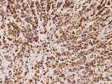 HSDL2 Antibody - Immunochemical staining of human HSDL2 in human adrenal gland with rabbit polyclonal antibody at 1:300 dilution, formalin-fixed paraffin embedded sections.