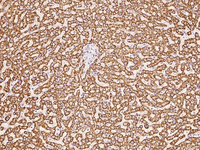 HSDL2 Antibody - Immunochemical staining of human HSDL2 in human liver with rabbit polyclonal antibody at 1:300 dilution, formalin-fixed paraffin embedded sections.