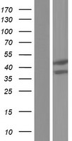 HSDL2 Protein - Western validation with an anti-DDK antibody * L: Control HEK293 lysate R: Over-expression lysate