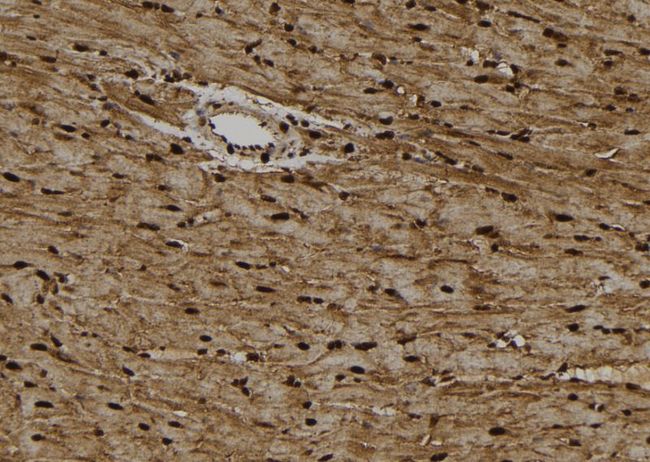 HSET / KIFC1 Antibody - 1:100 staining rat heart tissue by IHC-P. The sample was formaldehyde fixed and a heat mediated antigen retrieval step in citrate buffer was performed. The sample was then blocked and incubated with the antibody for 1.5 hours at 22°C. An HRP conjugated goat anti-rabbit antibody was used as the secondary.