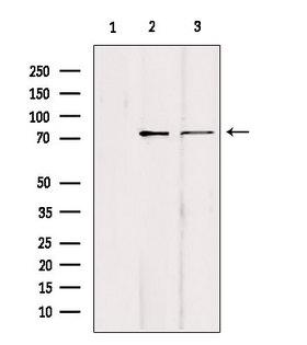 HSET / KIFC1 Antibody - Western blot analysis of extracts of various samples using KIFC1 antibody. Lane 1: mouse brain treated with blocking peptide. Lane 2: mouse brain; Lane 3: HepG2;