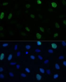 HSET / KIFC1 Antibody - Immunofluorescence analysis of U-2OS cells using KIFC1 Polyclonal Antibody at dilution of 1:100 (40x lens).Blue: DAPI for nuclear staining.