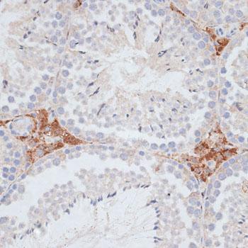 HSET / KIFC1 Antibody - Immunohistochemistry of paraffin-embedded Mouse testis using KIFC1 Polyclonal Antibody at dilution of 1:100 (40x lens).