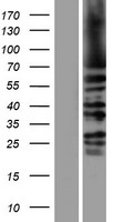 HSET / KIFC1 Protein - Western validation with an anti-DDK antibody * L: Control HEK293 lysate R: Over-expression lysate