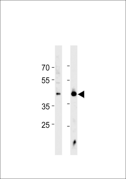 HSF1 Antibody - HSF1 Antibody western blot of Jurkat cell line and mouse heart tissue lysates (35 ug/lane). The HSF1 antibody detected the HSF1 protein (arrow).